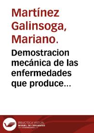 Demostracion mecánica de las enfermedades que produce el uso de las cotillas