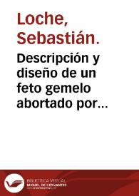 Descripción y diseño de un feto gemelo abortado por una mujer en Barcelona en el año 1774, que regala don Antonio de Gimbernat al gabinete del...