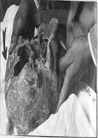 Más información sobre Fotografía del cráneo de Hernán Cortés al exhumarse
