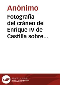 Portada:Fotografía del cráneo de Enrique IV de Castilla sobre un fragmento de tela que se encontró junto con el cadáver